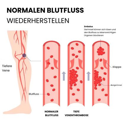 Neurosocken von Schulz-Orthopädie™